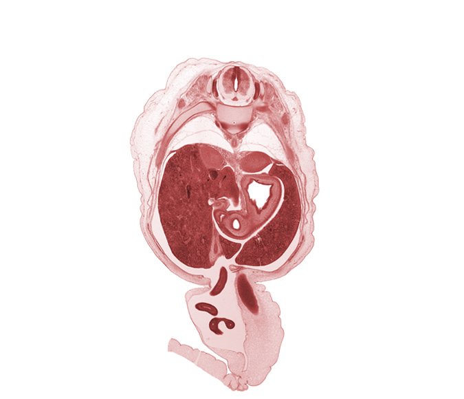 T-10 / T-11 intervertebral disc, T-10 intercostal nerve, T-10 spinal ganglion, T-10 spinal nerve, amnion on surface of umbilical cord, aorta, caudal edge of gall bladder, cephalic edge of testis, cystic duct, diaphragm, distal limb of herniated midgut, fundus of stomach, hepatic artery, hepatic portal vein, iliocostalis muscle, left lobe of liver, lesser sac (omental bursa), longissimus muscle, neural arch, proximal limb of herniated midgut, pyloric antrum of stomach, pyloric sphincter, quadrate lobe of liver, right lobe of liver, spinalis muscle, superior part of duodenum (first part), suprarenal gland cortex, umbilical vein