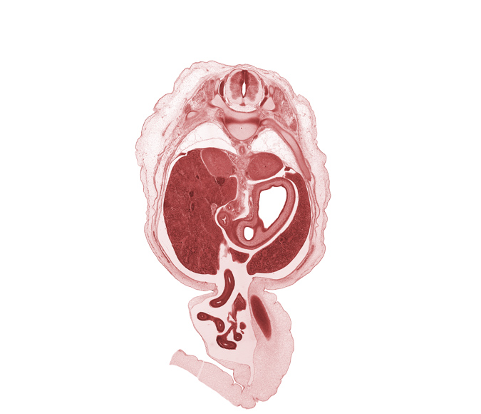 T-10 / T-11 intervertebral disc, T-10 spinal nerve, T-11 spinal ganglion, aorta, bile duct, distal limb of herniated midgut, inferior vena cava (hepatic part), jejunum, lumen of body of stomach, lumen of pyloric antrum of stomach, mucoid connective tissue, proximal limb of herniated midgut, rib 11, right lobe of liver, superior part of duodenum, suprarenal gland cortex, testis, umbilical cord, umbilical vein
