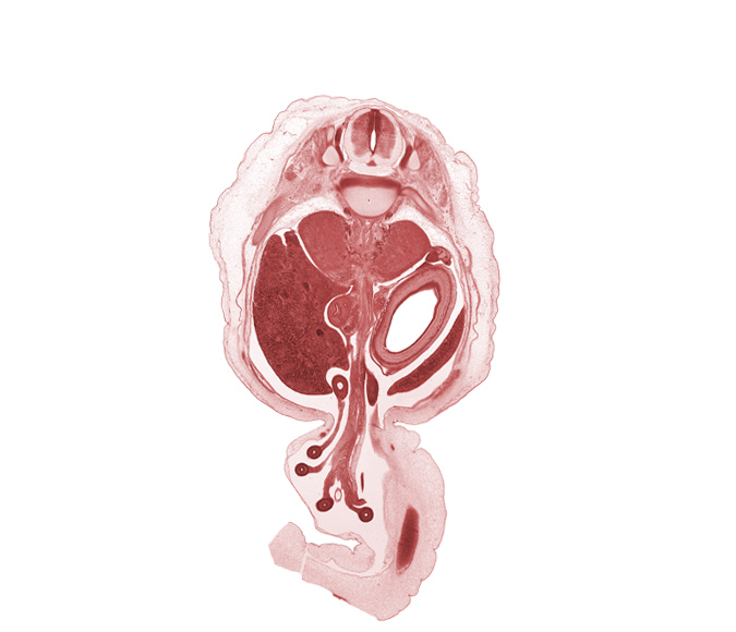 T-11 spinal nerve, T-12 spinal ganglion, allantois, aorta, body of dorsal pancreas, centrum of T-12 vertebra, descending part of duodenum (second part), distal limb of herniated midgut, hindgut (colon), jejunum, left lobe of liver, lumen of body of stomach, omphalomesenteric artery, peritoneal cavity, proximal limb of herniated midgut, rib 12, right lobe of liver, spleen, superior mesenteric artery, suprarenal gland cortex, umbilical coelom, umbilical vein