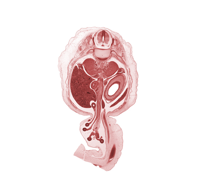 T-12 spinal ganglion, allantois, aorta, centrum of T-12 vertebra, descending part of duodenum (second part), distal limb of herniated midgut, dorsal mesogastrium, endoderm lining of stomach (mucosa), head of rib 12, head of ventral pancreas, hindgut (colon), jejunum, left umbilical artery, mesentery, muscularis of stomach, notochord, omphalomesenteric artery, proximal limb of herniated midgut, shaft of rib 12, spleen, superior mesenteric artery and vein, suprarenal gland cortex, testis, umbilical vein, vas deferens (mesonephric duct)