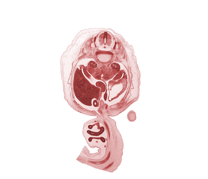 T-12 / L-1 intervertebral disc, T-12 spinal ganglion, T-12 spinal nerve, allantois, aorta, centrum of L-1 vertebra, cephalic edge of lower limb, duodenum, hindgut (colon), jejunum, kidney (metanephros), left umbilical artery, lesser sac (omental bursa), mesentery, mesocolon, proximal limb of herniated midgut, right umbilical artery, superior pole of right kidney (metanephros), testis