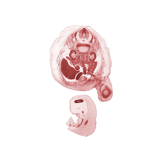 L-1 / L-2 intervertebral disc, L-1 spinal ganglion, L-1 spinal nerve, L-1 ventral root, L-2 spinal ganglion, aorta, caudal edge of junction of duodenum and jejunum, edge of omphalomesenteric artery, epididymis, femur, gubernaculum of testis, hilum of kidney (metanephros), hindgut, inferior vena cava (subcardinal vein), left umbilical artery, proximal limb of herniated midgut, right lobe of liver, right umbilical artery, sartorius muscle, sympathetic trunk, testis, umbilical cord, ureter, urinary bladder, vas deferens (mesonephric duct)