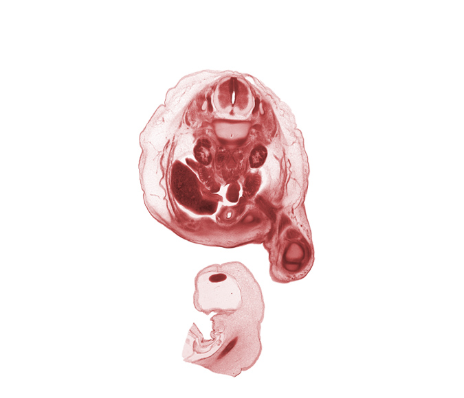 L-2 spinal ganglion, aorta, caudal edge of proximal limb of herniated midgut, centrum of L-2 vertebra, edge of pubis, femur, gubernaculum of testis, inferior vena cava (subcardinal vein), inguinal canal region, kidney (metanephros), knee joint, mesosigmoid, right lobe of liver, sigmoid colon, testis, tibia, umbilical coelom, ureter, urinary bladder, vas deferens (mesonephric duct)