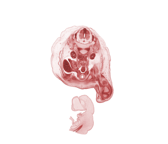 L-2 / L-3 intervertebral disc, L-2 spinal ganglion, L-2 ventral root, amnion on surface of umbilical cord, aorta, caudal edge of liver, epididymis, external abdominal oblique muscle, gubernaculum of testis, inferior pole of kidney (metanephros), inferior vena cava (subcardinal vein), internal abdominal oblique muscle, medial condyle of tibia, medial epicondyle of femur, pubis, testis, transversus abdominis muscle, umbilical coelom, ureter, urinary bladder, vas deferens (mesonephric duct)