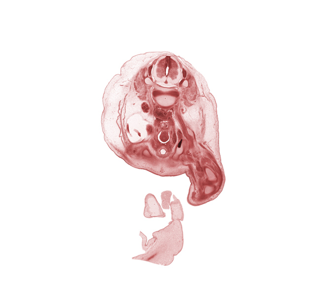 L-2 / L-3 intervertebral disc, L-2 dorsal root, L-2 spinal ganglion, L-2 spinal nerve, L-3 spinal ganglion, aorta, centrum of L-3 vertebra, femur, gubernaculum of testis, inferior pole of kidney (metanephros), junction of ureter and urinary bladder, knee joint, neural arch, peritoneal cavity, sigmoid colon, subarachnoid space, testis, tibia, umbilical coelom, umbilical cord, urinary bladder, vas deferens (mesonephric duct)