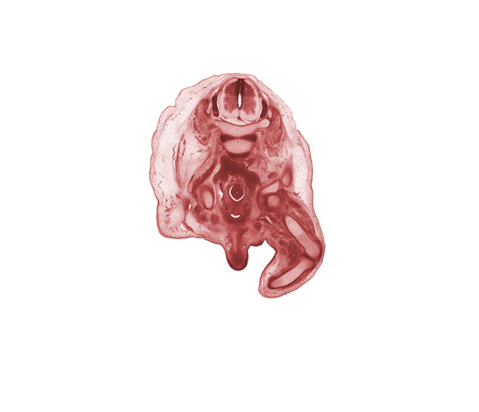 L-3 / L-4 intervertebral disc, L-3 spinal ganglion, L-3 spinal nerve, anterior spinal artery, aortic bifurcation, base of urinary bladder, blastemata of adductor muscles, common iliac artery, corpus cavernosum, femur, gubernaculum of testis, inferior vena cava (sacrocardinal vein), knee joint, neural canal, pubis, quadriceps femoris muscle, scrotal swelling, shaft of penis, sigmoid colon, tibia, ureter