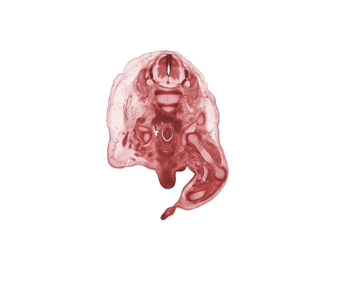 L-3 / L-4 intervertebral disc, L-3 spinal ganglion, L-3 spinal nerve, L-4 / L-5 intervertebral disc, L-4 spinal ganglion, distal end of femur, head of femur, hip joint, iliac crest, quadriceps femoris muscle, shaft of penis, sigmoid colon, tibia, tibial nerve, ureter, urinary bladder neck