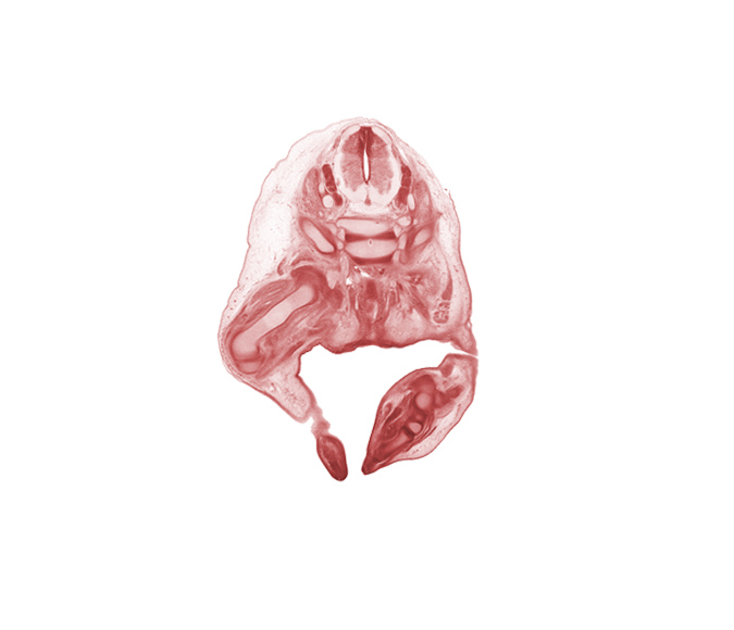 L-5 spinal ganglion, S-1 / S-2 intervertebral region, S-1 spinal ganglion, S-1 spinal nerve, S-2 / S-3 intervertebral region, S-2 spinal nerve, anal canal, anal pit, central canal, extensor tendon of foot, femur, intermediate zone, marginal zone, rectum, scrotal swelling, subarachnoid space, ventricular zone