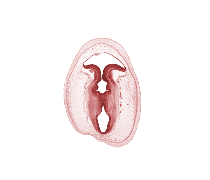 artifact separation(s), cerebral aqueduct (mesencoel), isthmus of metencephalon, rhombencoel (fourth ventricle), roof of rhombencoel (fourth ventricle), subarachnoid space, sulcus limitans, tectum, tegmentum, vascular plexus