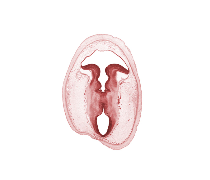 artifact separation(s), cerebral aqueduct (mesocoele), cerebral peduncle, isthmus of metencephalon, mesencephalon, osteogenic layer, rhombencoel (fourth ventricle), subarachnoid space, sulcus limitans, tectum, tegmentum, trochlear nerve (CN IV), vascular plexus