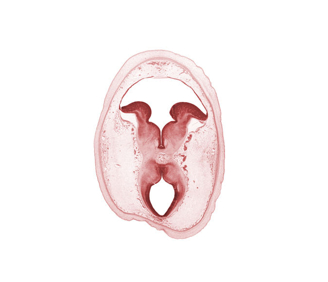 alar plate(s), artifact separation(s), basal plate, cerebral peduncle, floor plate, interpeduncular fossa, interpeduncular nucleus, roof of rhombencoel (fourth ventricle), roof plate of mesencephalon, subarachnoid space, sulcus limitans, tectum, tegmentum, trochlear nerve (CN IV)