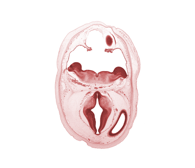 artifact separation(s), basilar artery, diverticulum of rhombencoel (fourth ventricle), dorsal thalamus, edge of alar plate of myelencephalon, hypothalamic sulcus, hypothalamus, lateral ventricle, metencephalon, oculomotor nerve (CN III), osteogenic layer, roof of diencephalon, subarachnoid space, sulcus dorsalis, third ventricle, trochlear nerve (CN IV)