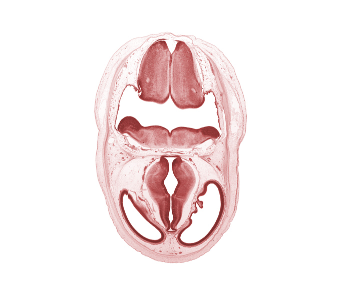 artifact separation(s), dural band for tentorium cerebelli, edge of choroid plexus, edge of endolymphatic duct, floor of diencephalon, lateral ventricle, oculomotor nerve (CN III), osteogenic layer, rhombencoel (fourth ventricle), roof of diencephalon, third ventricle, vascular plexus