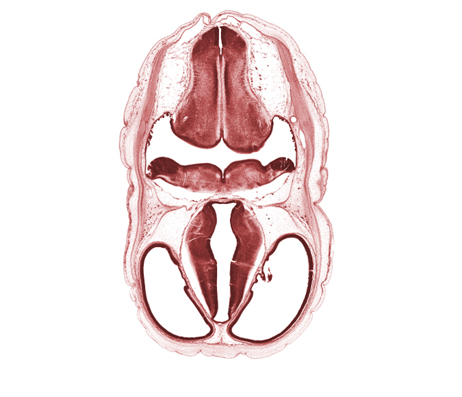 basilar artery, central canal of myelencephalon, cerebral vesicle (hemisphere), decussation, dorsal thalamus, endolymphatic sac, exoccipital, fiber tract, hypothalamus, intermediate zone, lateral ventricle, marginal zone, median sulcus, posterior communicating artery, posterior dural venous plexus, roof plate, third ventricle, ventral thalamus, ventricular zone