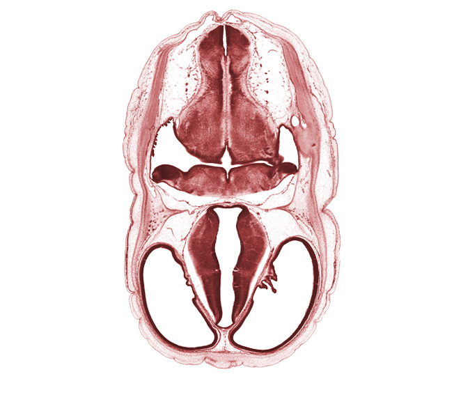 artifact space(s), cerebral vesicle (telencephalon), dural band for tentorium cerebelli, endolymphatic duct, endolymphatic sac, hypothalamic sulcus, lateral recess of rhombencoel (fourth ventricle), lateral ventricle, median sulcus, oculomotor nerve (CN III), osteogenic layer, rhombencoel (fourth ventricle), root of glossopharyngeal nerve (CN IX), root of vagus nerve (CN X), subarachnoid space, sulcus dorsalis, sulcus medius, third ventricle, trochlear nerve (CN IV), venous plexus(es)