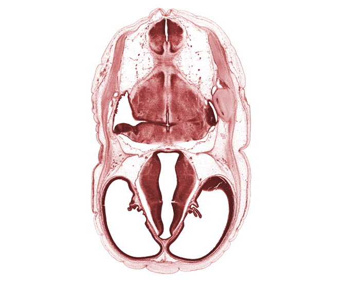 alar plate(s), basal plate, choroid plexus, decussation in floor plate, dorsal thalamus, dural band for tentorium cerebelli, endolymphatic duct, glossopharyngeal nerve (CN IX), hypothalamic sulcus, hypothalamus, lateral recess of rhombencoel (fourth ventricle), lateral ventricle, marginal ridge, oculomotor nerve (CN III), osteogenic layer, roof plate of myelencephalon, root of vagus nerve (CN X), sigmoid sinus, sulcus dorsalis, sulcus limitans, trochlear nerve (CN IV), venous plexus(es), ventral thalamus