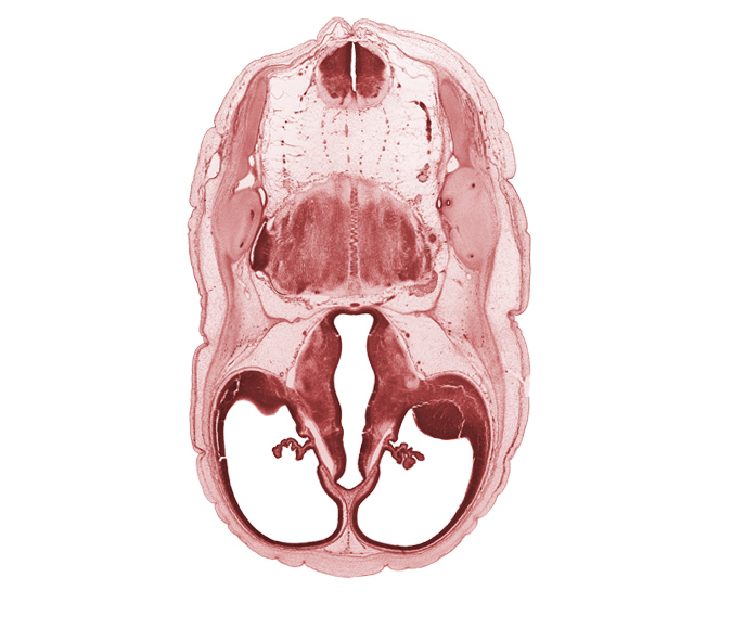 accessory nerve (CN XI), anterior semicircular duct, basilar artery, central canal of myelencephalon, common crus, dorsal thalamus, endolymphatic duct, exoccipital, fiber tract, glossopharyngeal nerve (CN IX), hypothalamus, lateral ventricle, lateral ventricular eminence (telencephalon), otic capsule cartilage, posterior communicating artery, stem of posterior dural venous plexus, vagus nerve (CN X), ventral thalamus