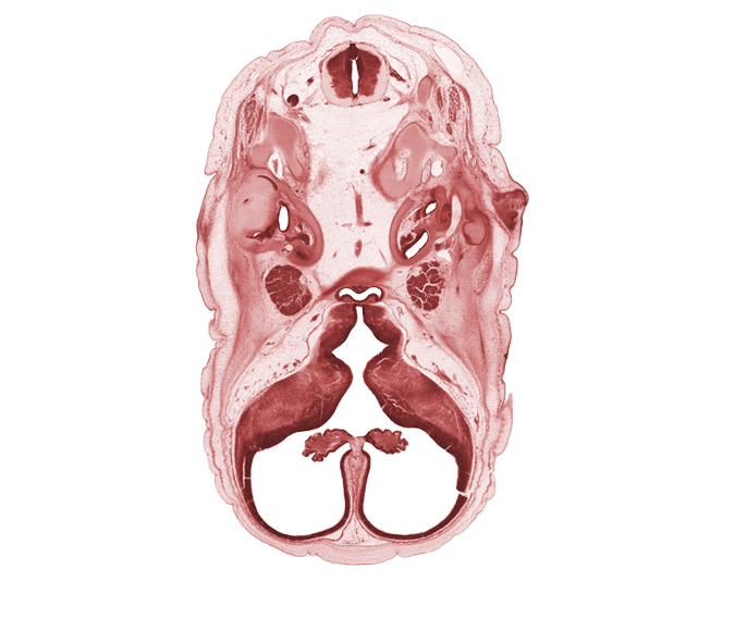 abducens nerve (CN VI), adenohypophysis, artifact separation(s), auricle, falx cerebri region, geniculate ganglion (CN VII), horizontal part of facial nerve (CN VII), hypothalamic sulcus, hypothalamus, intermediate zone, lateral ventricle, lateral ventricular eminence (telencephalon), marginal zone, medial ventricular eminence (diencephalon), motor root of trigeminal nerve (CN V), pharyngeal arch 1 cartilage (Meckel), posterior semicircular duct, roof plate of diencephalon, saccule(s), sella tursica region, spinal accessory nerve (CN XI), subarachnoid space, temporalis muscle, third ventricle, ventricular zone