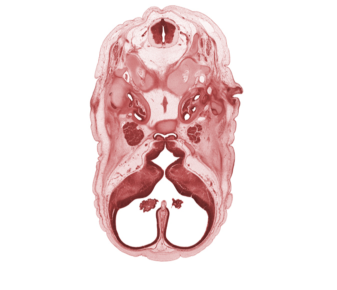 abducens nerve (CN VI), adenohypophysis, alar plate(s), basal plate, basi-occipital (basal plate), basilar artery, edge of choroid plexus, floor plate, hypoglossal nerve (CN XII), interventricular foramen, lateral semicircular duct, lateral ventricle, lateral ventricular eminence (telencephalon), medial ventricular eminence (diencephalon), neural arch of C-1 vertebra (atlas), occipital condyle, optic groove, orbitosphenoid, posterior communicating artery, roof plate, sulcus limitans, third ventricle, vagus nerve (CN X)