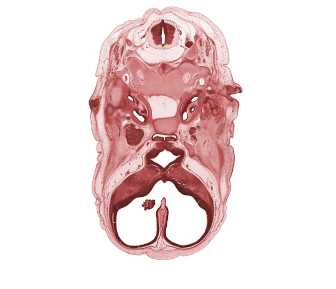 C-2 spinal ganglion, atlanto-occipital joint, auricular cartilage condensation, cephalic edge of auricle, cochlear duct, cranial cavity, facial nerve (CN VII), hypoglossal canal, intermediate zone, internal carotid artery, lateral ventricular eminence (telencephalon), lumen of adenohypophysis, marginal zone, medial ventricular eminence (diencephalon), ophthalmic nerve (CN V₁), optic groove, spinal accessory nerve (CN XI), third ventricle, tip of cochlear duct, vascular plexus, ventricular zone