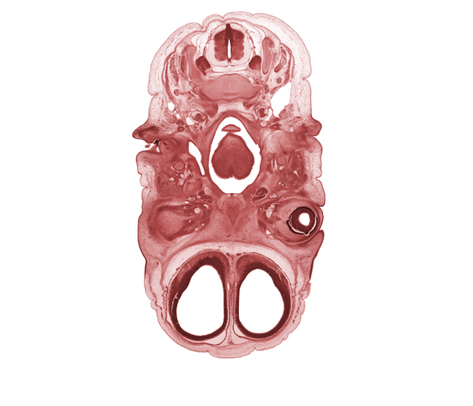 C-3 spinal ganglion, C-3 spinal nerve, cephalic edge of epiglottis, dura mater, edge of optic cup cavity, ethmoid, extrinsic ocular muscle(s), facial nerve (CN VII), glossopharyngeal nerve (CN IX), intraretinal space (optic vesicle cavity), laryngeal pharynx, optic nerve (CN II), oropharynx, osteogenic layer, pharyngeal arch 2 cartilage, pharyngeal hypophysis, spinal accessory nerve (CN XI), subarachnoid space, tongue, vascular plexus