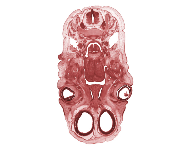 C-4 spinal ganglion, arytenoid swelling, epiglottis, falx cerebri region, glossopharyngeal nerve (CN IX), hypoglossal nerve (CN XII), intermediate zone, intraretinal space (optic vesicle cavity), jugular lymph sac, lens, levator palprebae superioris muscle, marginal zone, olfactory bulb, olfactory epithelium (placode), olfactory filia (CN I), optic cup cavity, osteogenic layer, pharyngeal arch 1 cartilage (Meckel), pterygoid muscle blastema, upper eyelid, ventricular zone