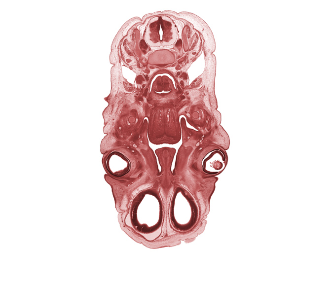 C-4 spinal ganglion, C-4 spinal nerve, artifact space(s), arytenoid swelling, caudal edge of auricle, cerebral vesicle (hemisphere), choana, cornea, glottis, horizontal layer of intrinsic muscles of tongue, intraretinal space (optic vesicle cavity), lens, lingual nerve, longitudinal intrinsic muscles of tongue, lower eyelid, nasal cavity (nasal sac), olfactory bulb, olfactory epithelium (placode), olfactory filia (CN I), optic cup cavity, palatine shelf, semispinalis capitis muscle, semispinalis cervicis muscle, spinal accessory nerve (CN XI), splenius muscle, sternocleidomastoid muscle, trapezius muscle, upper eyelid