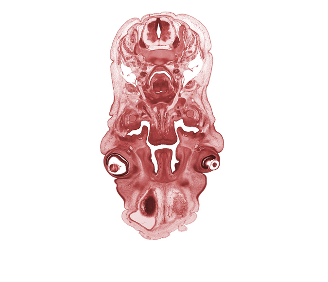 C-5 spinal ganglion, central canal, cerebral vesicle (hemisphere), cornea, edge of cerebral vesicle (hemisphere), glottis, hypoglossal nerve (CN XII), internal carotid artery, internal jugular vein, larynx, lens, lower eyelid, middle cervical sympathetic ganglion, nasal septal cartilage, neural arch, neural layer of retina, pigmented layer of retina, semispinalis capitis muscle, semispinalis cervicis muscle, splenius muscle, subarachnoid space, trapezius muscle, upper eyelid, vagus nerve (CN X), vertebral artery