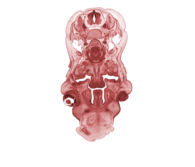 C-5 spinal ganglion, C-5 spinal nerve, artifact fracture(s), body of hyoid (pharyngeal arch 3 cartilage), choana, edge of eyeball, geniohyoid muscle, head mesenchyme, inferior alveolar nerve, inferior ganglion of vagus nerve (CN X), infra-orbital nerve, internal carotid artery, internal jugular vein, laryngeal pharynx, mandible, middle pharyngeal constrictor muscle, nasal cavity (nasal sac), osteogenic layer, palatine shelf, platysma muscle, sternocleidomastoid muscle, vertebral artery