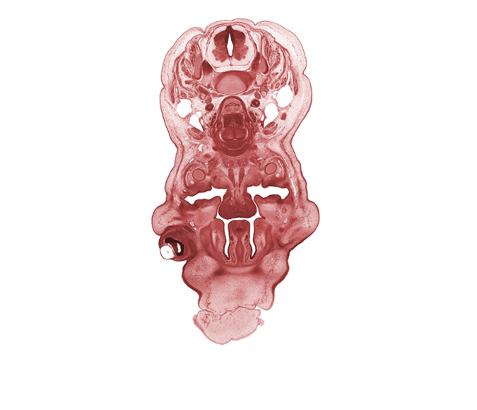 C-5 spinal nerve, anterior spinal vessels, head mesenchyme, inferior meatus, inferior nasal concha, internal jugular vein, interorbital ligament, jugular lymph sac, mandible, nasal cavity (nasal sac), oral cavity, palatine shelf, pharyngeal endoderm, platysma muscle, spinal accessory nerve (CN XI), sternocleidomastoid muscle, subarachnoid space, trapezius muscle