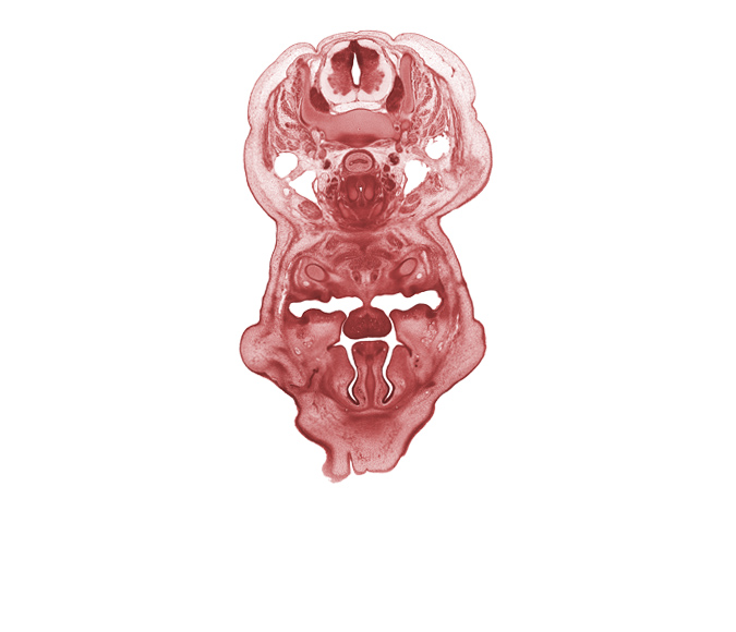 C-6 spinal ganglion, choana, frenulum of tongue, genioglossus muscle, geniohyoid muscle, inferior meatus, inferior nasal concha, internal jugular vein, interorbital ligament, jugular lymph sac, longus cervicis muscle, nasolacrimal duct, neural arch, oral cavity, palatine shelf, pharyngeal arch 1 cartilage (Meckel), platysma muscle, sternocleidomastoid muscle, thyroid cartilage, trapezius muscle