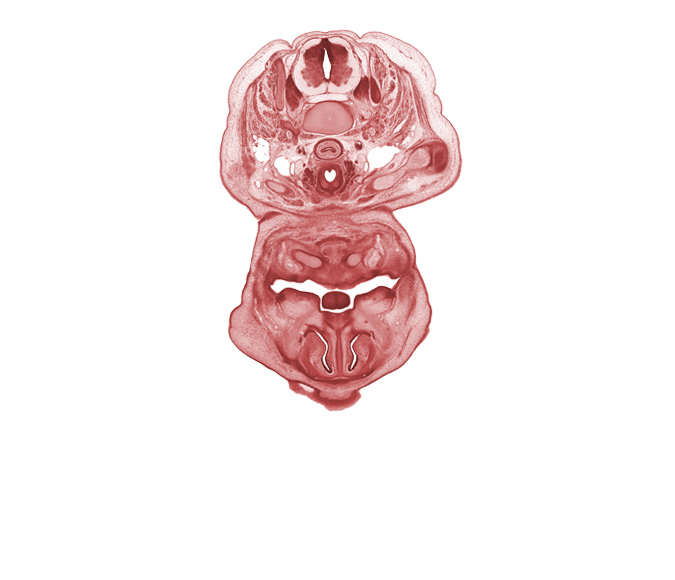 C-6 spinal ganglion, C-6 spinal nerve, anal pit, buccal region, clavicle, common carotid artery, external jugular vein, inferior alveolar nerve, infra-orbital lamina (facial muscle blastemata), internal jugular vein, middle cervical sympathetic ganglion, nasal capsule cartilage condensation, nasal cavity (nasal sac), nasal septal cartilage, pharyngeal arch 1 cartilage (Meckel), primary palate, semispinalis capitis muscle, semispinalis cervicis muscle, splenius muscle, subarachnoid space, thyroid gland, tongue, trapezius muscle