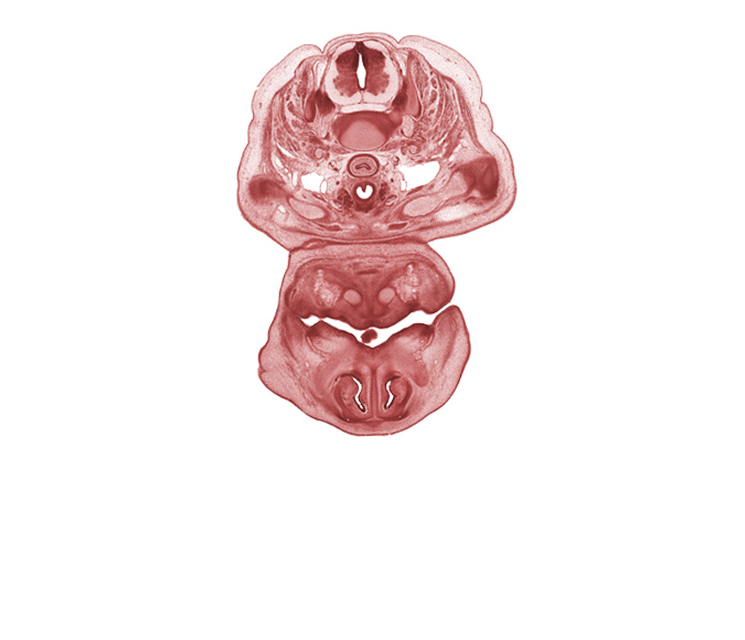 C-5 / C-6 intervertebral disc, C-6 spinal ganglion, C-6 spinal nerve, acromion process of scapula, angle of mouth, clavicle, esophagus, inferior nasal concha, nasal capsule cartilage condensation, nasal cavity (nasal sac), nasal septal cartilage, neural arch, oral cavity, pharyngeal arch 1 cartilage (Meckel), platysma muscle, primary palate, semispinalis capitis muscle, semispinalis cervicis muscle, splenius muscle, thyroid gland, tip of tongue, trachea, trapezius muscle, vagus nerve (CN X)