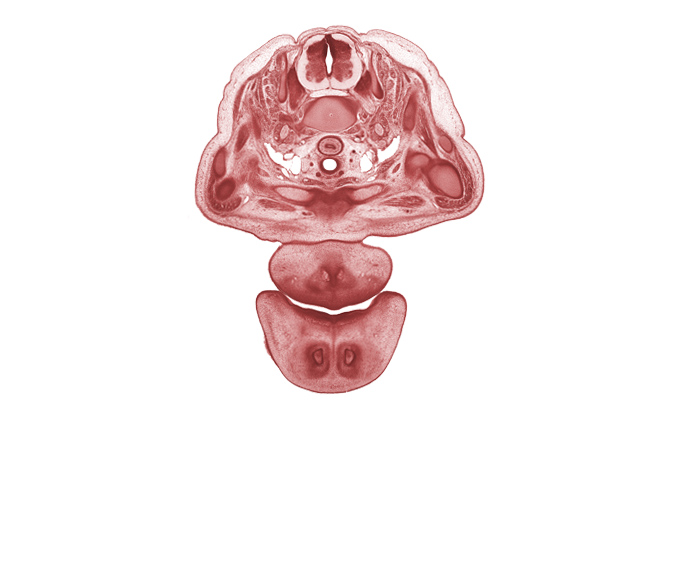 C-7 spinal ganglion, C-7 spinal nerve, anterior scalene muscle, central canal, dorsal horn of grey matter, epithelial plug in naris, esophagus muscularis, jugular lymph sac, longus cervicis muscle, primary palate, sympathetic trunk, tracheal lumen, upper trunk of brachial plexus (C-5, C-6), vagus nerve (CN X), ventral edge of pharyngeal arch 1 cartilage (Meckel), ventral horn of grey matter, white matter