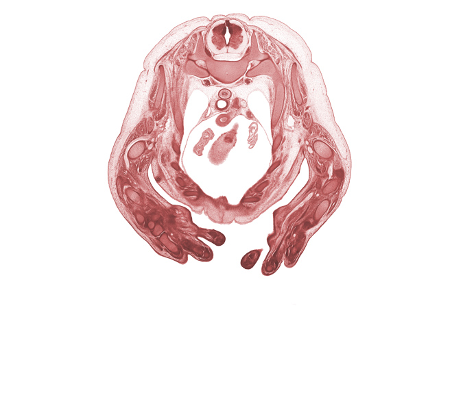 T-1 / T-2 interganglion region, aorta, ascending aorta, auricle of left atrium, auricle of right atrium, capitate, central canal, digit 5 (little finger), esophagus, head of ulna, hemisternum, humerus, metacarpal 4, neural arch, radial nerve, radius, rib 2, rib 3, rib 4, rib 5, right ventricle, superior vena cava, sympathetic trunk, trachea, vagus nerve (CN X)