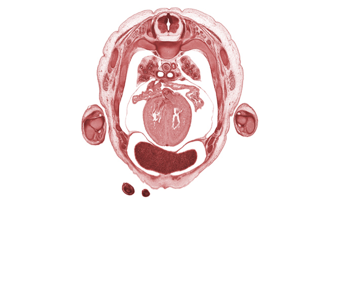 T-3 spinal ganglion, aortic semilunar valve, azygos vein, central tendon of diaphragm, digits (fingers), esophagus, left lobe of liver, left ventricle, neural arch, osteogenic layer, pericardial cavity, peritoneal cavity, pleural cavity, pleural recess, primary bronchus, rib 4, rib 5, right lobe of liver, right ventricle, subarachnoid space, sulcus limitans, superior hemi-azygos vein, sympathetic trunk, ulnar nerve, upper lobe of left lung