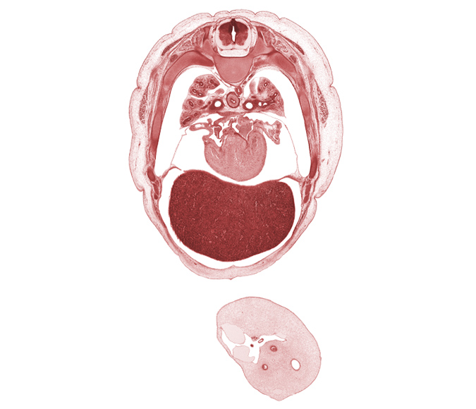 T-4 / T-5 interganglion region, allantois, azygos vein, latissimus dorsi muscle, left lobe of liver, left umbilical artery, left ventricle, lower secondary bronchus, primary interatrial septum (septum primum), rib 5, right atrium, right lobe of liver, right umbilical artery, right ventricle, serratus anterior muscle, sinus venosus, trapezius muscle, umbilical vein, upper lobe of left lung