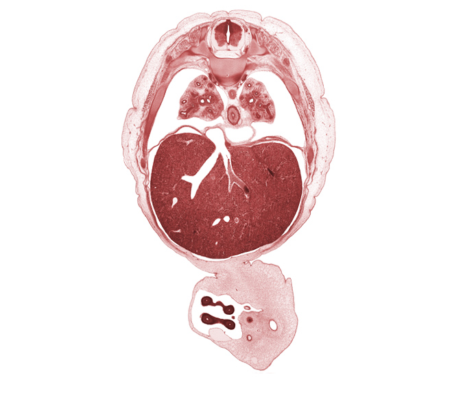 T-6 / T-7 interganglion region, allantois, aorta, caudal edge of pericardial cavity, distal limb of herniated midgut, efferent hepatic vein, esophagus, junction of hepatic veins and inferior vena cava, left lobe of liver, left umbilical artery, left vagus nerve (CN X), lower lobe of right lung, proximal limb of herniated midgut, rib 8, rib 9, right lobe of liver, right umbilical artery, right vagus nerve (CN X), sympathetic trunk, umbilical coelom, umbilical vein, umbilical vesicle stalk