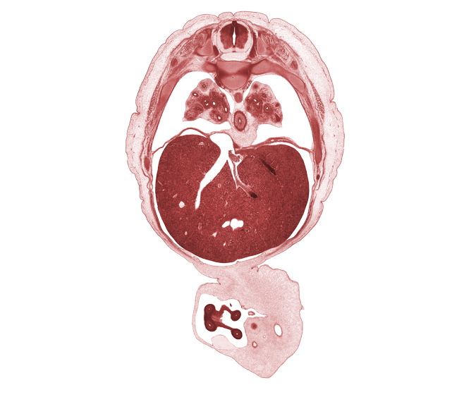 T-7 spinal ganglion, T-8 spinal nerve, allantois, amnion, caudal edge of pericardial sac, central tendon of diaphragm, distal limb of herniated midgut, efferent hepatic vein, esophagus, lower lobe of left lung, lower lobe of right lung, pleural recess, proximal limb of herniated midgut, pulmogenic coat, rib 8, surface ectoderm, sympathetic trunk, umbilical coelom, umbilical vein