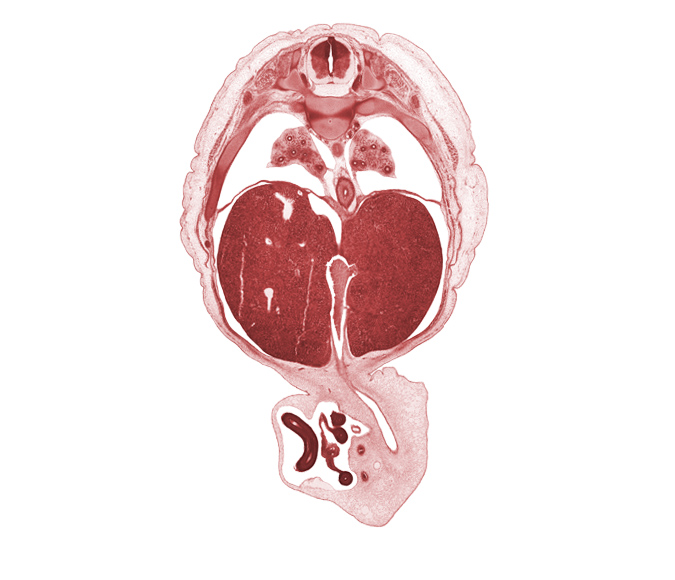 T-8 / T-9 intervertebral disc, T-8 spinal ganglion, allantois, artifact fracture(s), ductus venosus, left umbilical artery, lower lobe of left lung, lower lobe of right lung, notochord, pleural cavity, proximal limb of herniated midgut, pulmonary ligament, rib 9, right umbilical artery, umbilical vein, umbilical vesicle stalk