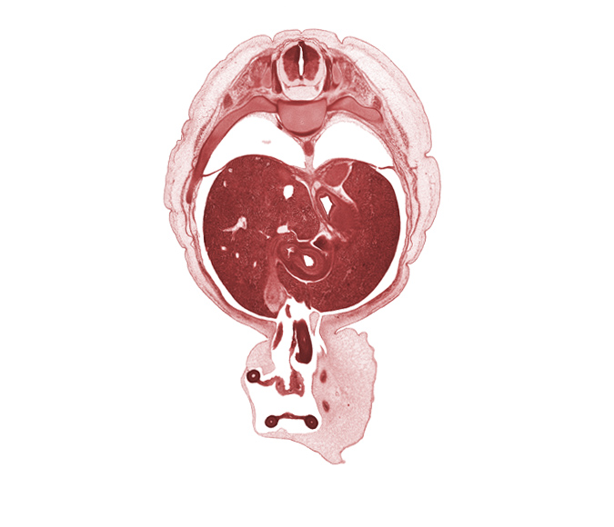 T-9 spinal ganglion, alar plate(s), allantois, aorta, basal plate, common hepatic duct, cystic duct, distal limb of herniated midgut, edge of umbilical vesicle stalk, epiploic foramen, first part of duodenum, floor plate, fundus of stomach, inferior vena cava, left lobe of liver, left umbilical artery, proximal limb of herniated midgut, pyloric antrum of stomach, pyloric sphincter, quadrate lobe of liver, rib 10, right umbilical artery, roof plate, sulcus limitans