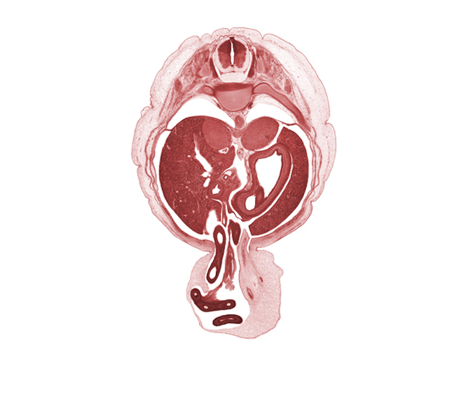 T-10 / T-11 intervertebral disc, T-10 spinal ganglion, allantois, aorta, bile duct, body of stomach, central canal, distal limb of midgut, duodenum, fundus of stomach, head of ventral pancreas, hepatic artery, hepatic portal vein, left lobe of liver, left umbilical artery, midpoint of herniated midgut loop, proximal limb of herniated midgut, rib 11, right lobe of liver, right umbilical artery, suprarenal gland cortex, umbilical vesicle stalk