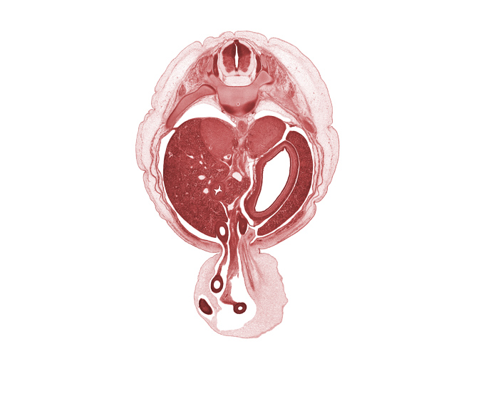 T-11 spinal ganglion, allantois, aorta, caudal edge of pleural cavity, cephalic edge of mesonephros, distal part of duodenum, duodenum (second part), greater curvature of stomach, hepatic portal vein, iliocostalis muscle, left lobe of liver, left umbilical artery, longissimus muscle, neural arch, peritoneal cavity, proximal limb of herniated midgut, right umbilical artery, spinalis muscle, superior mesenteric vessels, suprarenal gland cortex