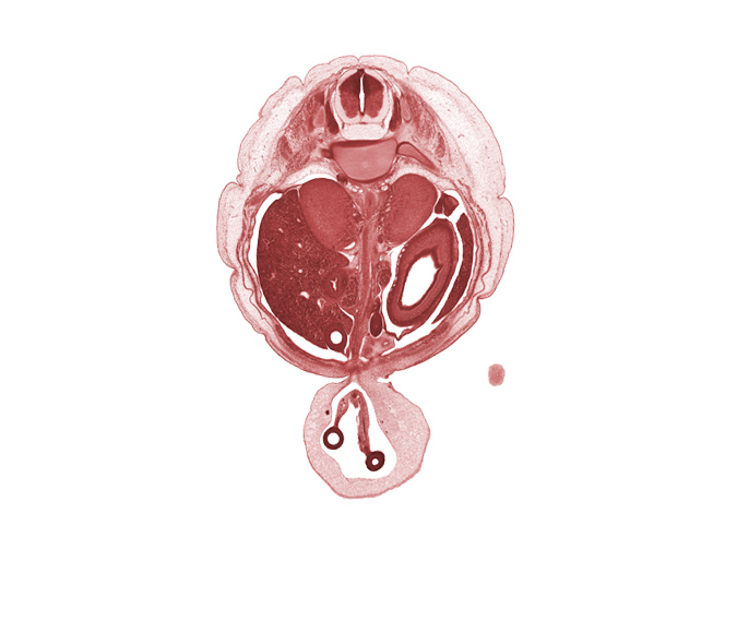 T-11 spinal ganglion, allantois, aorta, centrum of T-12 vertebra, cephalic edge of lower limb, duodenum, dura mater, grey matter, hindgut, left lobe of liver, left umbilical artery, mesentery, ovary, peritoneal cavity, proximal limb of herniated midgut, rib 12, right lobe of liver, right umbilical artery, subarachnoid space, superior mesenteric artery, umbilical coelom, white matter