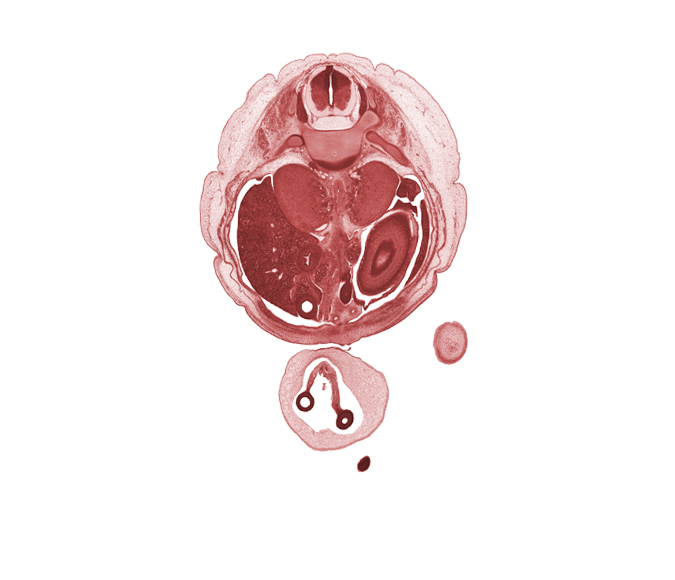 T-11 spinal ganglion, allantois, amnion on surface of umbilical cord, aorta, body of dorsal pancreas, caudal edge of left lobe of liver, cephalic edge of left foot, distal part of duodenum, external abdominal oblique muscle, head of ventral pancreas, iliocostalis muscle, internal abdominal oblique muscle, left umbilical artery, longissimus muscle, lower limb, mesonephros, origin of superior mesenteric artery, proximal limb of herniated midgut, rectus abdominis muscle, rib 12, right umbilical artery, spinalis muscle, spleen, subarachnoid space, transversus abdominis muscle, umbilical coelom