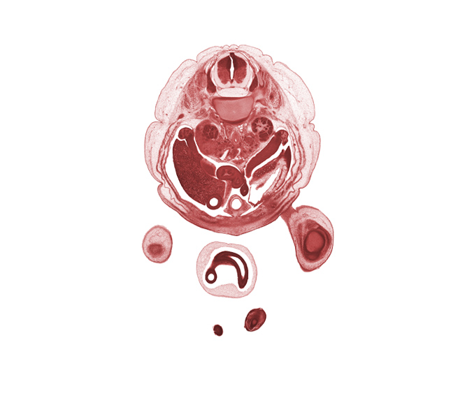 T-12 spinal ganglion, aorta, body of dorsal pancreas, duodenum, dura mater, hindgut, left kidney (metanephros), mesonephros, ovary, right lobe of liver, spleen, subarachnoid space, superior pole of right kidney (metanephros), toe of left foot, umbilical coelom