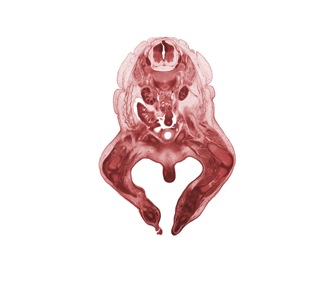 L-1 spinal ganglion, L-2 spinal ganglion, artifact fracture(s), clitoris, femoral nerve, femur, hindgut, kidney (metanephros), knee joint, labial swelling (labium major), median sacral artery, metatarsal(s), patella, psoas major muscle, pubis, quadriceps femoris muscle, right common iliac artery, tarsal region, tibia, ureter