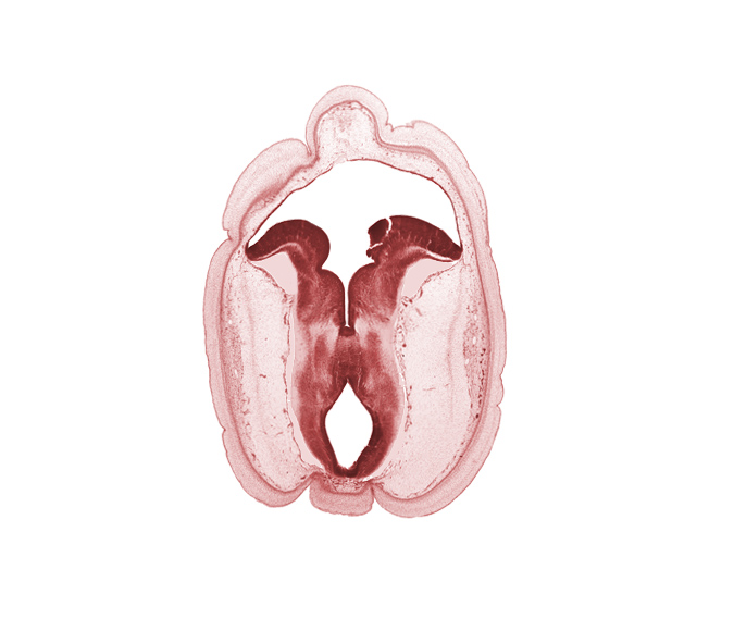 artifact fracture(s), cerebral aqueduct (mesocoele), fiber tract in basal plate, floor plate, head mesenchyme, median sulcus, rhombencoel (fourth ventricle), subarachnoid space, sulcus limitans, tectum of mesencephalon, tegmentum of mesencephalon, trochlear nerve (CN IV)