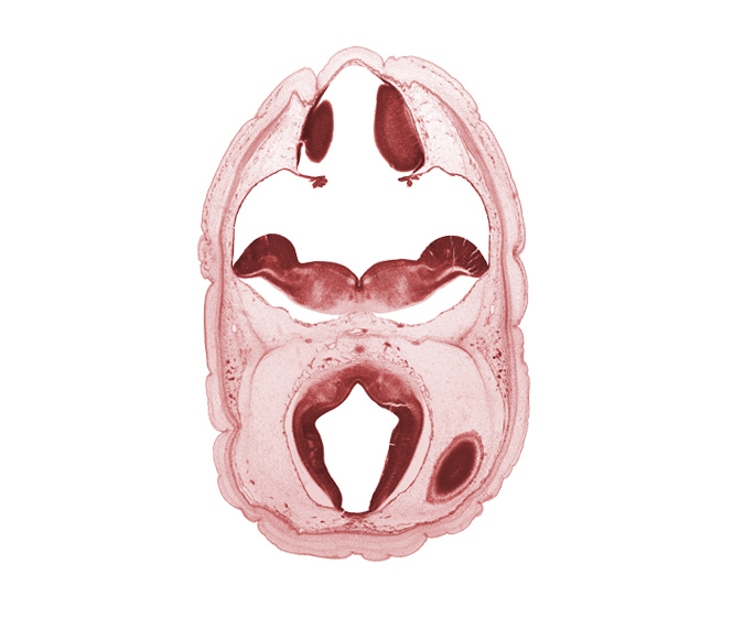 alar plate of myelencephalon, artifact space(s), cephalic end of basilar artery, cerebral aqueduct (mesocoele), cerebral vesicle (hemisphere), choroid plexus, dural band for tentorium cerebelli, oculomotor nerve (CN III), osteogenic layer, rhombencoel (fourth ventricle), roof plate of myelencephalon, subarachnoid space, sulcus limitans, trochlear nerve (CN IV)