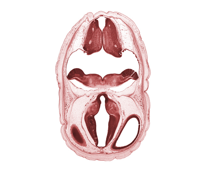 artifact space(s), diencephalon, dorsal thalamus, dural band for tentorium cerebelli, fiber tract, hypothalamus, metencephalon, myelencephalon, obex, oculomotor nerve (CN III), osteogenic layer, roof plate, roof plate of diencephalon, subarachnoid space, ventral thalamus, wall of cerebral vesicle (hemisphere)